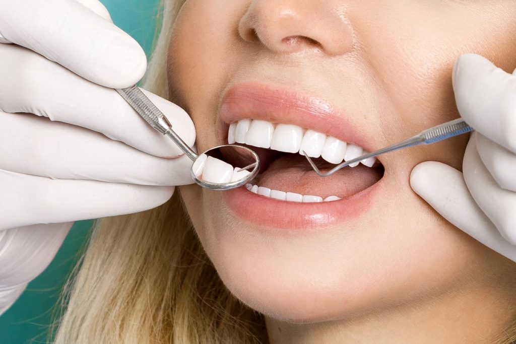 Woman white white teeth having a check up