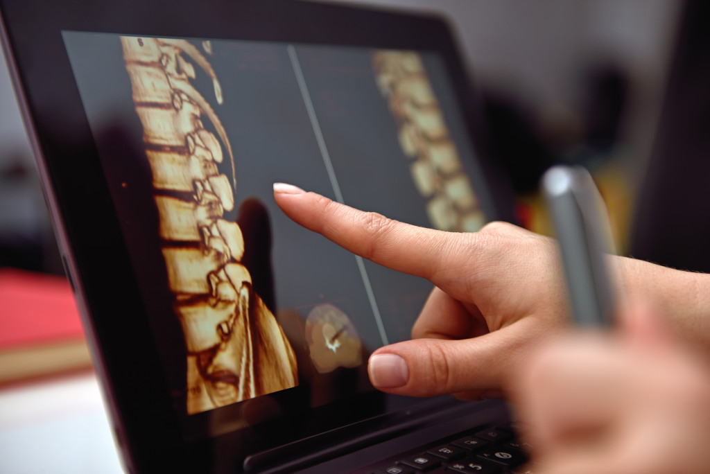doctor pointing at spine image